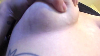 My Stretch Marks