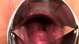 Amateur Asian Japanese Anal Creampie