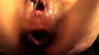 Anal Extreme